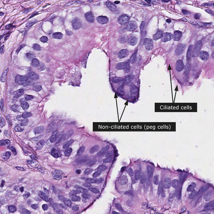 somersault musician Breakthrough Dictionary - Normal: Fallopian tube - The Human Protein Atlas